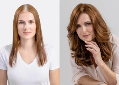 Vorher-Nachher-Vergleich einer Frau mit lichtem Scheitel, die eine MicroLines-Haarverdichtung von Hairdreams bekommen hat.